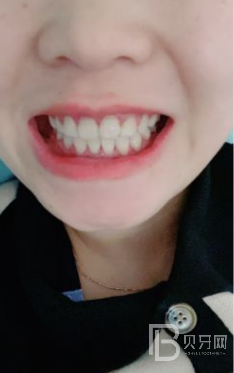 網(wǎng)友親身經(jīng)歷，齒康口腔做牙齒矯正怎么樣？靠譜嘛？