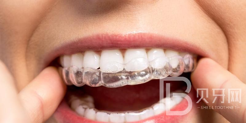 牙齒矯正后容易反彈嗎?這種情況需謹(jǐn)慎！