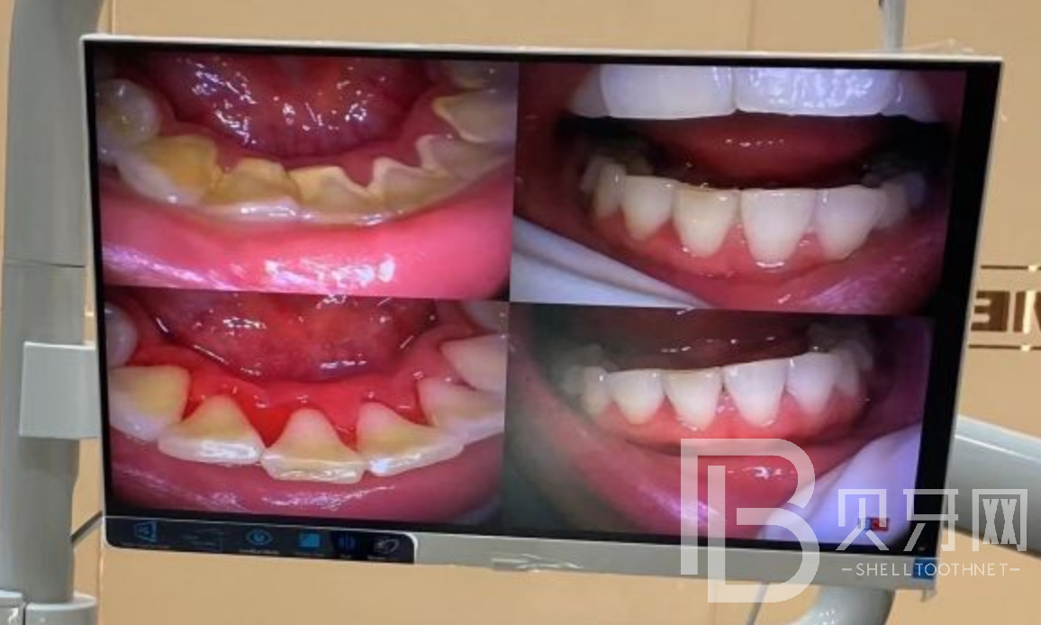 深圳佳美口腔口碑怎么樣？