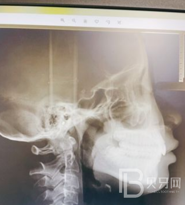 深圳瑞爾齒科做牙齒矯正靠譜嗎？