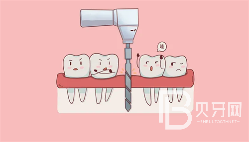 盤點(diǎn)上?？谇慌琶笆t(yī)院！治牙齒找放心醫(yī)院！