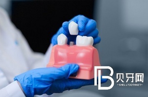 上海雅悅口腔怎么樣，聽說做種植牙醫(yī)生技術(shù)不錯(cuò)？