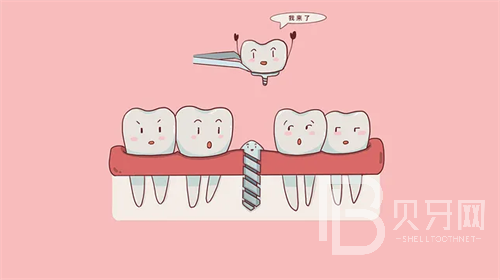 上海華齒口腔做牙收費(fèi)貴嗎？看看診療價(jià)格這幾項(xiàng)很便宜！