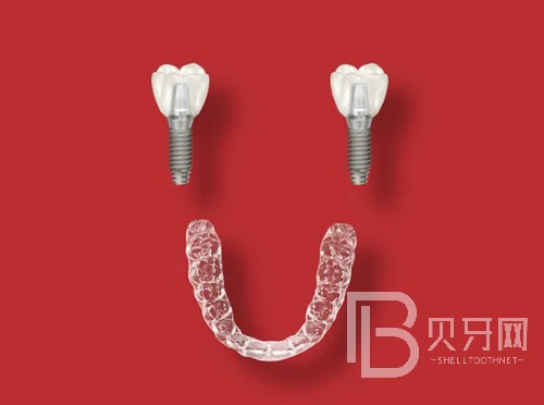 上海成人牙齒矯正大概價格多少錢，費用價格都是怎么算的