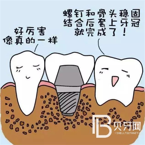 上海億大口腔怎么樣？地址簡介擅長項(xiàng)目等公開！