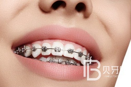 北京西諾口腔怎么樣？西諾口腔口碑怎么樣？