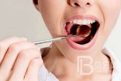 上?？谇会t(yī)院哪家好？上海圣貝口腔的口碑怎么樣？