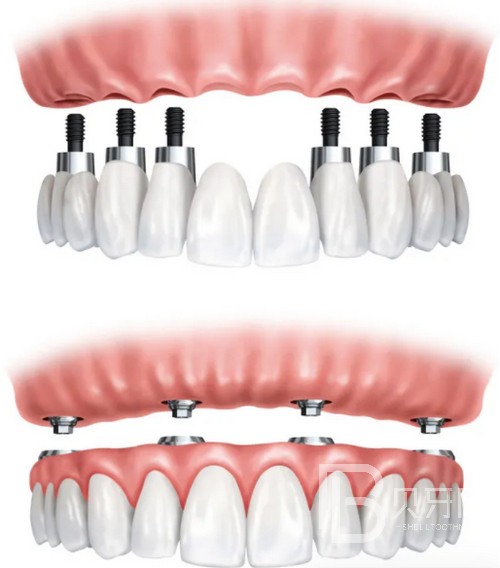 南京康美口腔好不好？收費貴嗎？公布具體地址