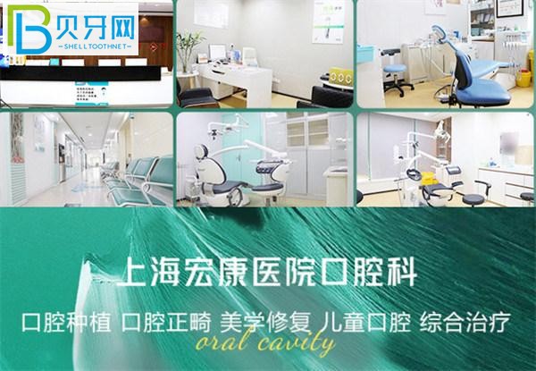 上海弘康醫(yī)院口腔科如何預(yù)約掛號