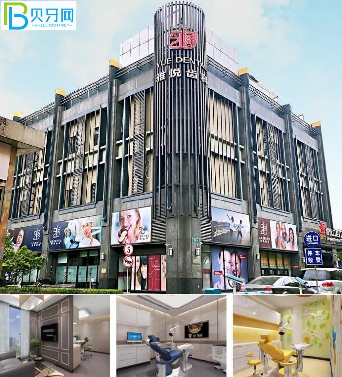 上海雅悅齒科種牙怎么樣?看上海當(dāng)?shù)厝嗽u價(jià)好用不貴還不疼!