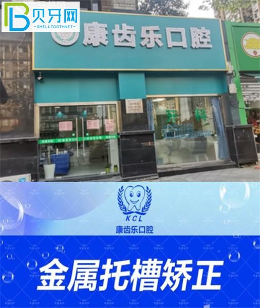 杭州康齒樂口腔收費標(biāo)準(zhǔn)價格表