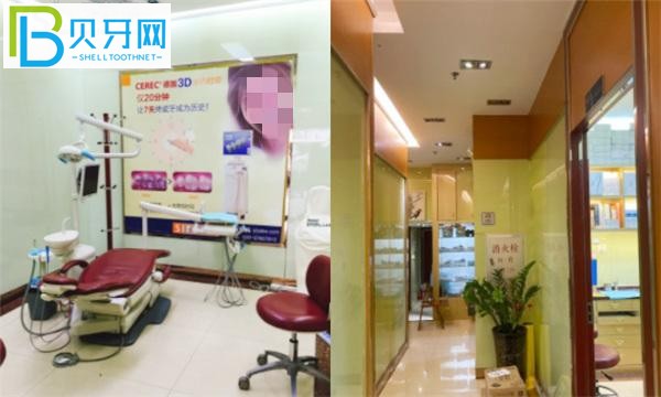 廣州金典牙科收費怎么樣