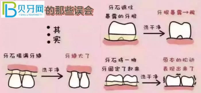 萬(wàn)州牙科醫(yī)院哪里好？推薦品善和牙博士?jī)杉铱诒玫难揽圃\所給你！
