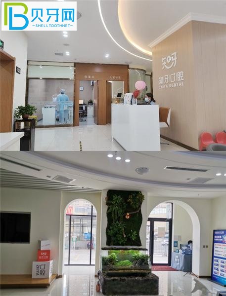 呼和浩特知牙口腔收費(fèi)標(biāo)準(zhǔn)價格表