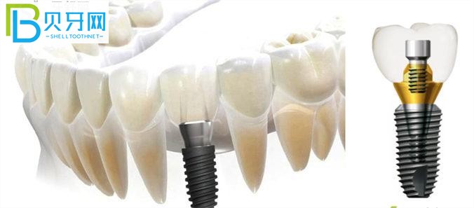 東莞天后口腔醫(yī)院怎么樣 是正規(guī)牙科機(jī)構(gòu)嗎口碑好不好