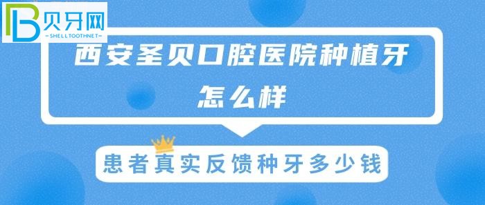 西安圣貝種植牙怎么樣，患者真實(shí)反饋種牙多少錢？(圖)