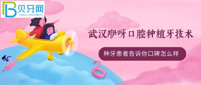 All-on-4/6種植牙技術(shù)好不好？(組圖)