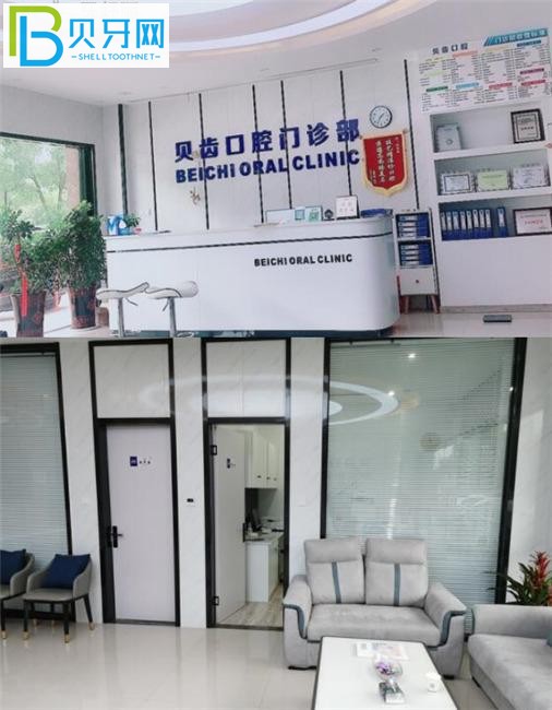 嘉興貝齒口腔環(huán)境圖片