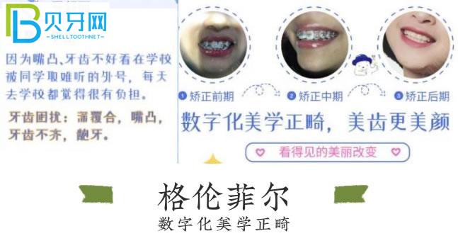 深圳格倫菲爾口腔好評多嗎