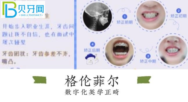 深圳格倫菲爾口腔好評多嗎