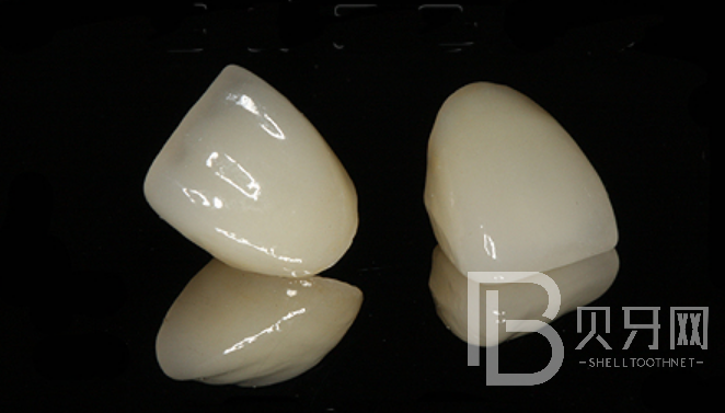 成都牙米口腔正規(guī)嗎？種植牙實(shí)力醫(yī)生推薦