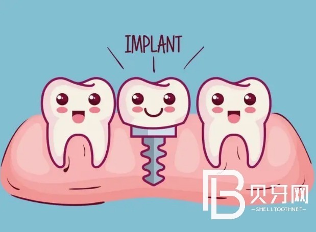 廣州柏德口腔種植牙好不好？收費(fèi)貴不貴？
