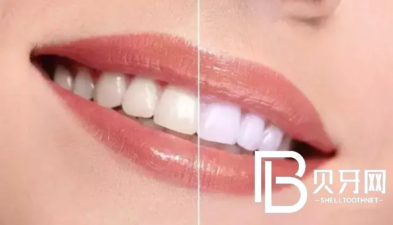 武漢雅貝康口腔怎么樣？醫(yī)生實(shí)力如何？