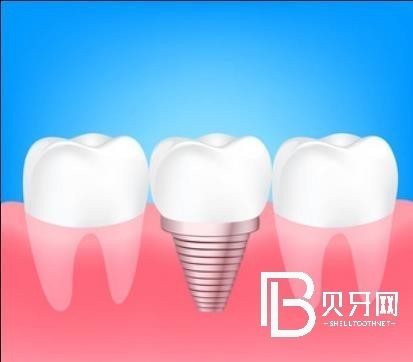 天津亞美口腔怎么樣？種植牙多少錢？