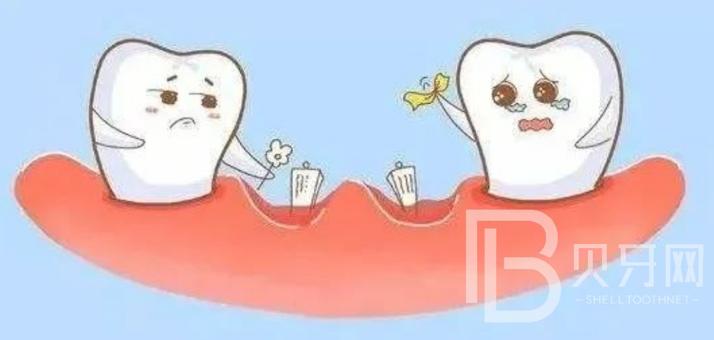 北京鈦植口腔上半口種植牙六顆好還是八顆好？