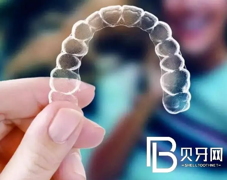 廈門微笑口腔好不好？附真實案例分享