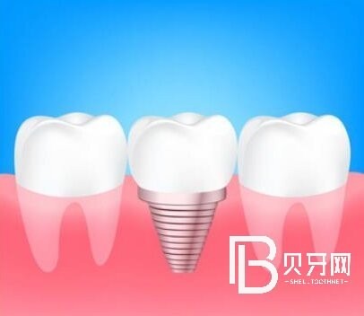 杭州博泰口腔口碑怎么樣？醫(yī)院正規(guī)嗎？