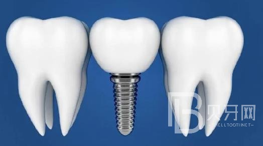 廣州致美口腔正規(guī)靠譜嗎？廣州致美口腔醫(yī)院位置在哪？