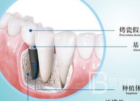 廣州優(yōu)德口腔正規(guī)靠譜嗎？廣州優(yōu)德口腔醫(yī)院位置在哪？