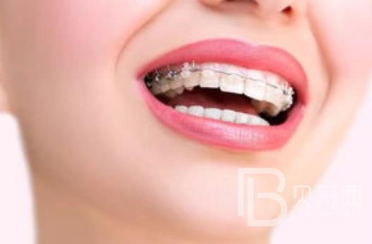 廣州潤博口腔正規(guī)靠譜嗎？廣州潤博口腔醫(yī)院位置在哪？