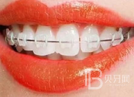 廣州愛頓口腔怎么樣？廣州愛頓口腔口碑好不好？廣州愛頓口腔種植牙價格