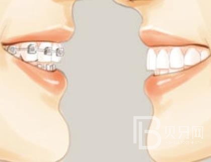 廣州雅皓口腔正規(guī)靠譜嗎？廣州雅皓口腔醫(yī)院位置在哪？