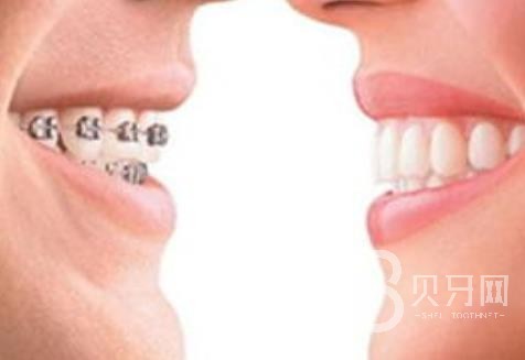 廣州歐立口腔怎么樣？廣州歐立口腔口碑好不好？廣州歐立口腔種植牙價格