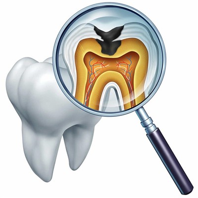 杭州種植一顆假牙多少錢！杭州張永珍口腔診所種植牙價(jià)格表參考，瑞典諾貝爾Active種植牙：13390元起/顆！