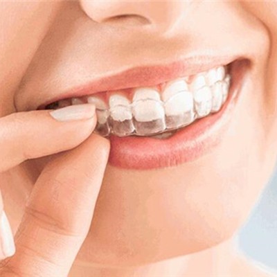 杭州種一顆牙要多少錢！杭州富陽昌華口腔診所種植牙醫(yī)院排名TOP1，德國卡瓦ABT種植體：6439元起/顆！