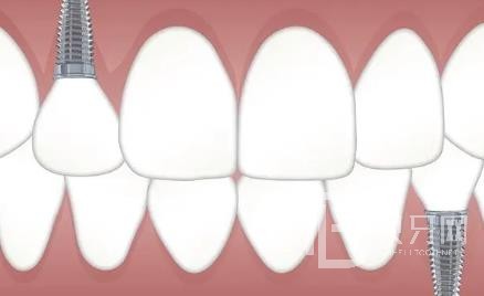 廣州壹加壹口腔正規(guī)靠譜嗎？廣州壹加壹口腔醫(yī)院位置在哪？