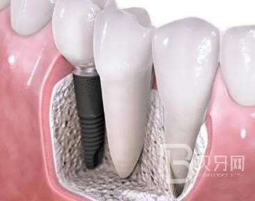 廣州牙美佳口腔正規(guī)靠譜嗎？廣州牙美佳口腔醫(yī)院位置在哪？