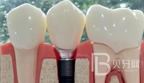 廣州華晨口腔正規(guī)靠譜嗎？廣州華晨口腔醫(yī)院位置在哪？