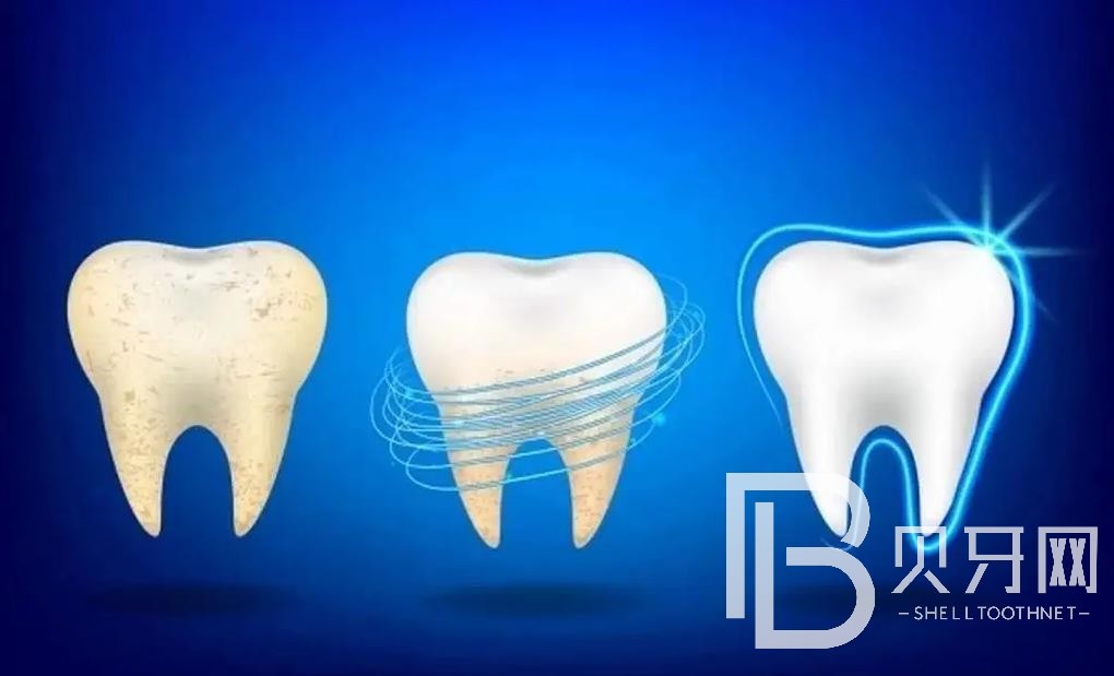 北京維爾口腔怎么樣？醫(yī)生實(shí)力如何？