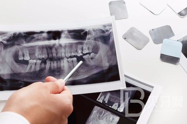 到底種植牙好還是鑲牙好？北京王府井口腔怎么樣？