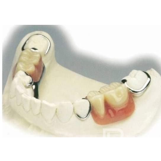 杭州種植一顆假牙多少錢！杭州潔奧口腔門診部(蕭山區(qū))種植牙價(jià)格表更新，國(guó)產(chǎn)康盛種植牙價(jià)格：3836元起/顆！