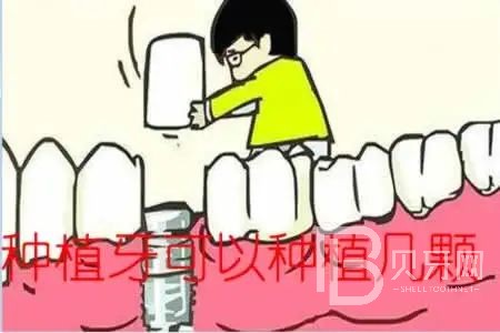 allon6種植牙是什么意思？東莞拜爾口腔