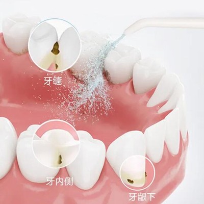 湖州種一顆牙要多少錢！湖州富民門診部2023全新種牙價(jià)目表，瑞典諾貝爾CC種植牙：8661元起/顆！