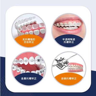 衢州冷光美白整牙醫(yī)院排名前十預(yù)測！衢州王江濱口腔收費都不貴的